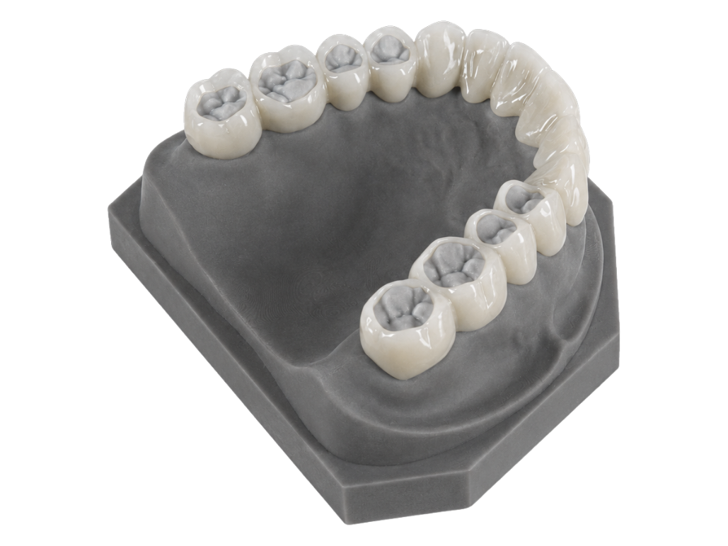 A removable cosmetic overlay on an upper model