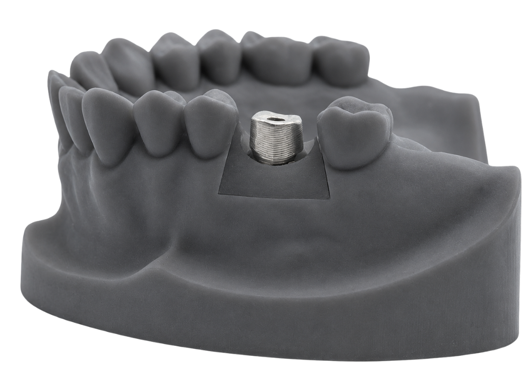 Milled custom implant abutments
