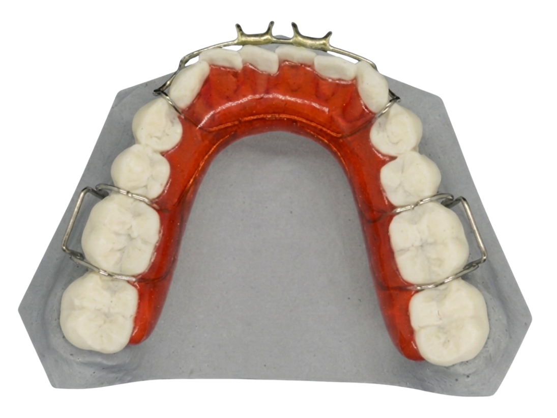 A removable functional appliance on a model, view 2
