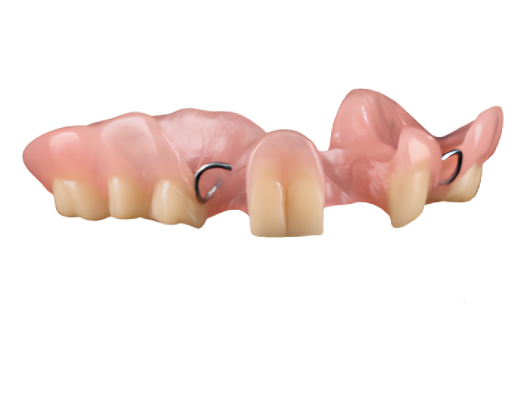 A cast partial denture on a stone model