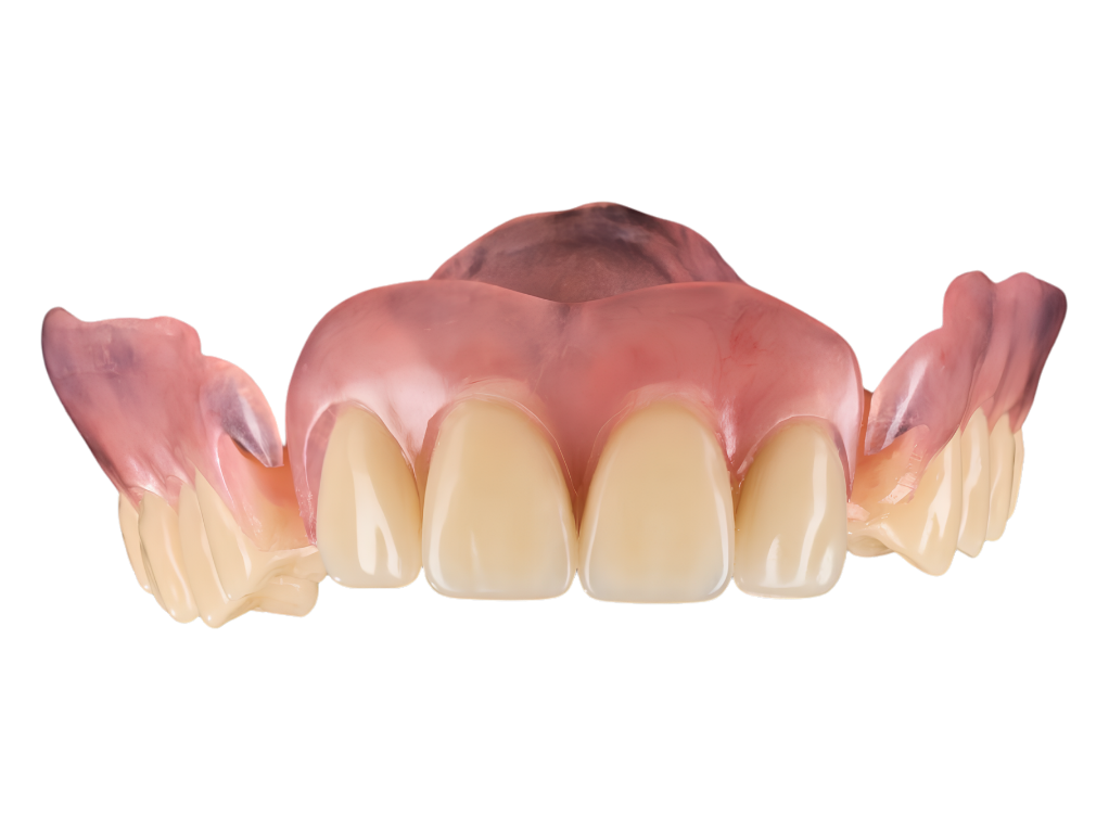 A denture prepared for reline and repair